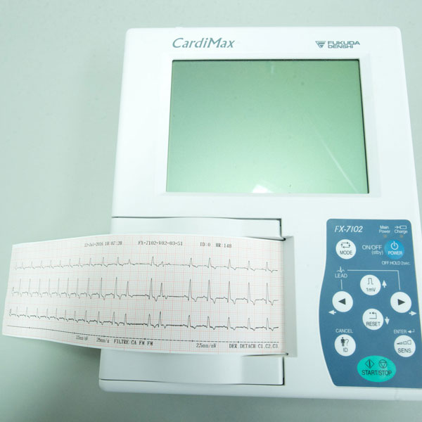 Electrocardiogramme